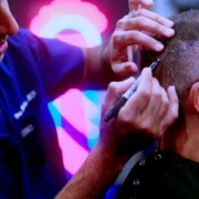 Best hair transplant chicago
